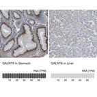 Anti-GALNT6 Antibody