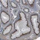Immunohistochemical staining of human stomach shows strong granular cytoplasmic positivity in glandular cells.