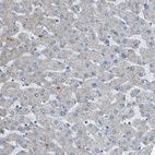 Immunohistochemical staining of human liver shows no positivity in hepatocytes as expected.