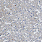 Anti-GALNT6 Antibody