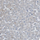 Immunohistochemical staining of human liver shows no positivity in hepatocytes as expected.
