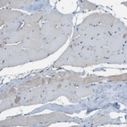 Immunohistochemical staining of human skeletal muscle shows no positivity in myocytes as expected.