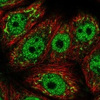 Immunofluorescent staining of human cell line MCF7 shows localization to nucleoplasm & the Golgi apparatus.