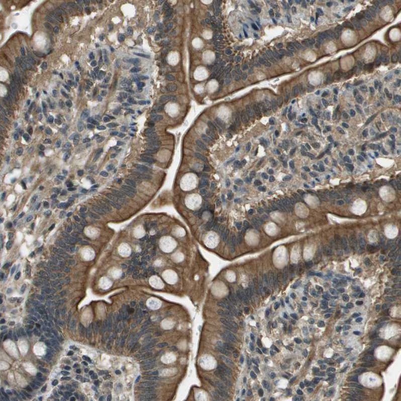 Rabbit Polyclonal Anti-SDC3 Antibody - Buy for research - Highly ...