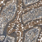 Immunohistochemical staining of human small intestine shows strong membranous positivity in glandular cells.