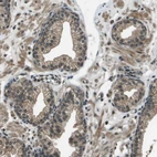 Immunohistochemical staining of human prostate shows moderate membranous positivity in glandular cells.