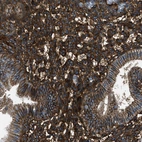 Immunohistochemical staining of human endometrium shows strong membranous positivity in glandular cells.