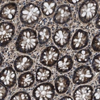 Immunohistochemical staining of human rectum shows strong cytoplasmic positivity in glandular cells.