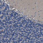 Immunohistochemical staining of human cerebellum shows negative cytoplasmic positivity in Purkinje cells as expected.