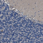 Immunohistochemical staining of human cerebellum shows negative cytoplasmic positivity in Purkinje cells as expected.