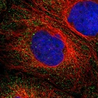 Immunofluorescent staining of human cell line A-431 shows localization to vesicles.