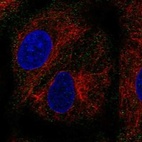 Anti-PEX11B Antibody