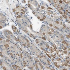 Anti-TAOK3 Antibody