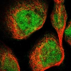 Immunofluorescent staining of human cell line A-431 shows localization to nucleoplasm & cytosol.