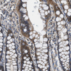 Immunohistochemical staining of human rectum shows moderate cytoplasmic positivity in glandular cells.