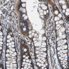 Immunohistochemical staining of human rectum shows moderate cytoplasmic positivity in glandular cells.