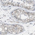 Immunohistochemical staining of human testis shows weak cytoplasmic positivity in cells in seminiferous ducts.