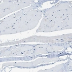 Immunohistochemical staining of human skeletal muscle shows no positivity in myocytes as expected.