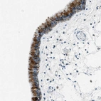 Immunohistochemical staining of human nasopharynx shows strong cytoplasmic positivity in respiratory epithelial cells.