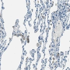 Immunohistochemical staining of human lung shows moderate cytoplasmic positivity in macrophages.