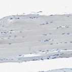 Immunohistochemical staining of human skeletal muscle shows no cytoplasmic positivity in myocytes as expected.
