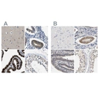 Anti-PGR Antibody