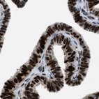 Immunohistochemical staining of human fallopian tube using Anti-PGR antibody HPA017176.