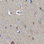 Immunohistochemical staining of human cerebral cortex using Anti-PGR antibody HPA017176.
