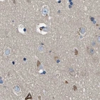 Immunohistochemical staining of human cerebral cortex using Anti-PGR antibody HPA017176.