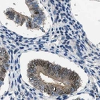 Immunohistochemical staining of human endometrium using Anti-PGR antibody HPA017176.