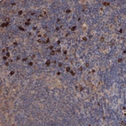 Immunohistochemical staining of human lymph node shows strong cytoplasmic/ membranous positivity in a small subset of lymphoid cells.