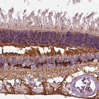 Anti-CRABP1 Antibody