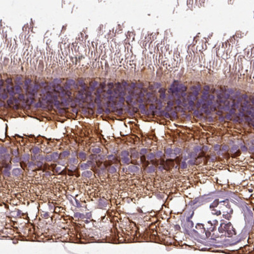 Anti-CRABP1 Antibody