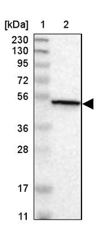 Lane 1: Marker [kDa] 230, 130, 95, 72, 56, 36, 28, 17, 11_br/_Lane 2: Human cell line RT-4