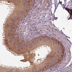 Immunohistochemical staining of human epididymis shows moderate to strong cytoplasmic positivity in glandular cells.