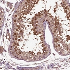 Immunohistochemical staining of human testis shows moderate to strong cytoplasmic positivity in cells in seminiferous ducts.