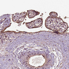 Anti-ERV3-1 Antibody