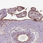 Immunohistochemical staining of human placenta shows moderate cytoplasmic positivity in trophoblastic cells.