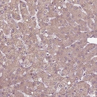 Immunohistochemical staining of human liver shows very weak cytoplasmic positivity in hepatocytes.