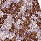 Anti-ERV3-1 Antibody