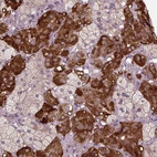 Immunohistochemical staining of human adrenal gland shows moderate to strong cytoplasmic positivity in glandular cells.