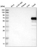 Western blot analysis in human cell line RT-4, human cell line U-251 MG, human plasma, human liver tissue and human tonsil tissue.