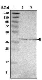 Lane 1: Marker [kDa] 230, 130, 95, 72, 56, 36, 28, 17, 11_br/_Lane 2: Human cell line RT-4_br/_Lane 3: Human cell line U-251MG sp