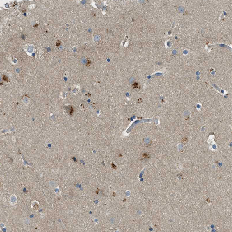 Anti-MAN2A2 Antibody