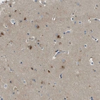 Anti-MAN2A2 Antibody