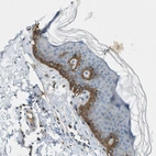 Immunohistochemical staining of human skin shows moderate to strong cytoplasmic positivity in epidermal cells.
