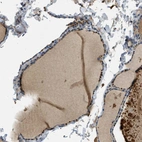 Immunohistochemical staining of human thyroid gland shows moderate to strong cytoplasmic positivity in glandular cells.