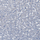 Immunohistochemical staining of human liver shows no cytoplasmic positivity in hepatocytes as expected.