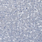 Immunohistochemical staining of human liver shows no cytoplasmic positivity in hepatocytes as expected.