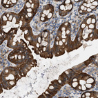 Immunohistochemical staining of human rectum shows strong cytoplasmic positivity in glandular cells.